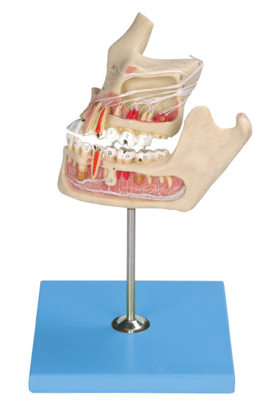 2 部についてのコンピュータによって一致する色の病理学の人間の歯モデル/顎モデル