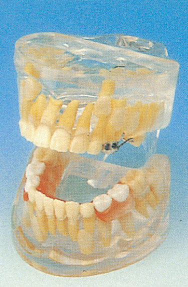 歯学部の人間の歯モデル/透明な乳歯の開発モデル