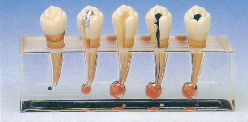 歯内療法学の臨床病理学モデルは医院の訓練のための 5 部を含んでいます