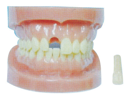 外の取り外し可能な歯モデルは病院および歯科防止の訓練を応援します