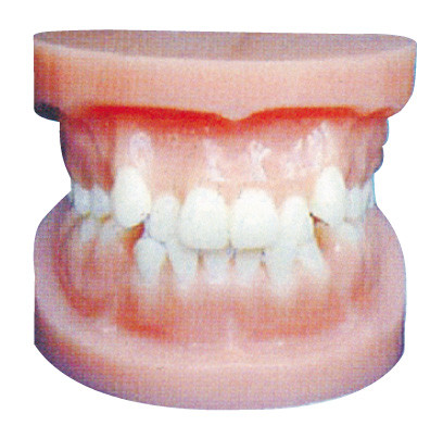 歯科インプラントは解剖訓練のための模倣しましたり/歯科矯正学モデル