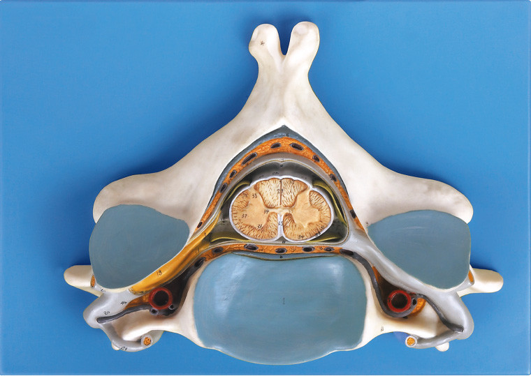 脊髄および神経の解剖人間の骨組モデルとの第 5 頚部 Vertrebra