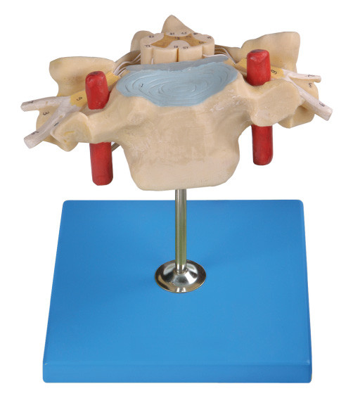 脊髄の人間の解剖学モデルとの頚部 Vertrebra は背骨動脈、静脈、神経を示します