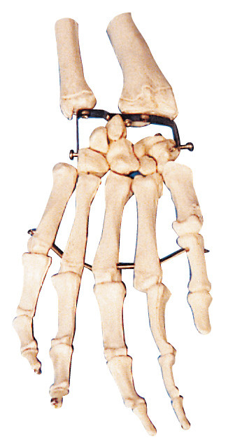 やし骨の衛生学校のための人間の解剖学モデル訓練モデル