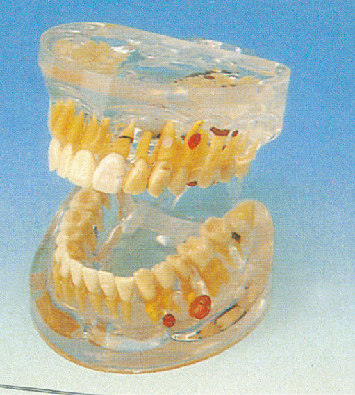 大人の透明な歯科病理学の大学訓練のための人間の歯モデル