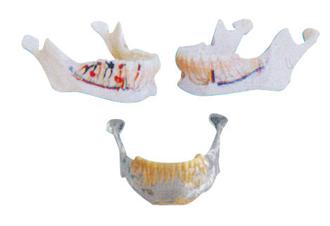歯科医の歯は神経、動脈および静脈が付いているあごモデルを模倣します