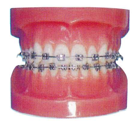 病院および歯科病院の訓練のための歯科矯正学の人間の歯モデル