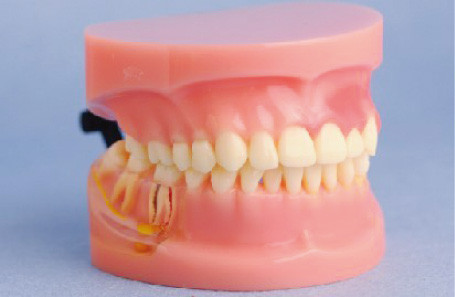 歯周病の医学大学および医院の訓練のための人間の歯モデルのモデル