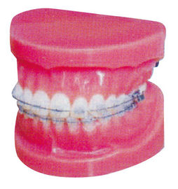 病院および衛生学校の訓練のための正常な固定歯科矯正学モデル