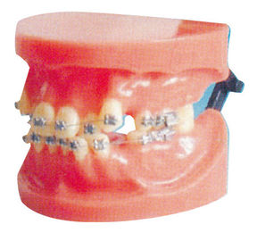 医学大学および歯科病院の訓練のための転位の固定歯科矯正学モデル